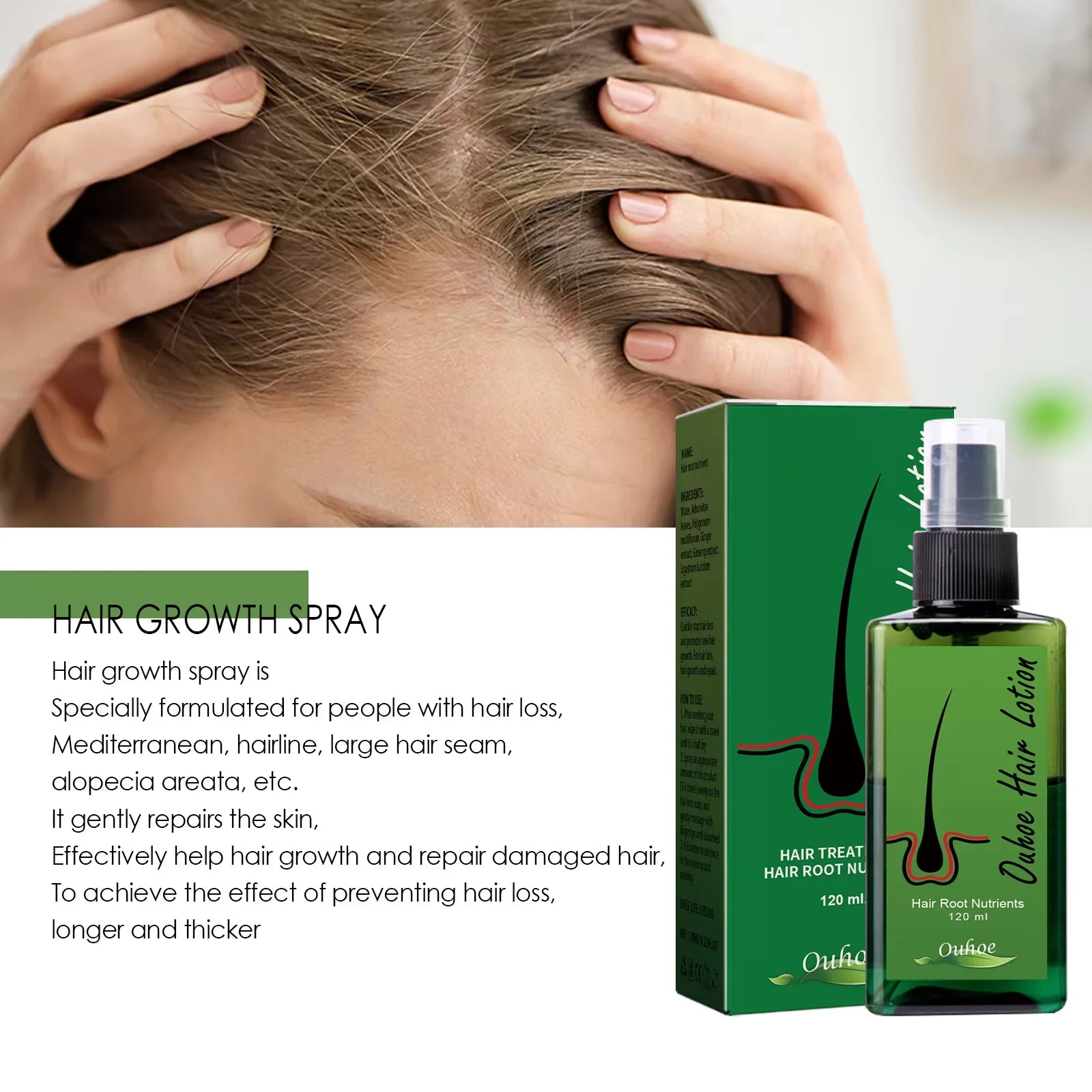 Hair Growth Spray anti Hair Loss Baldness Hair Root Repair Damaged Scalp Treatment Serum Liquid Thickening Longer Beauty Health