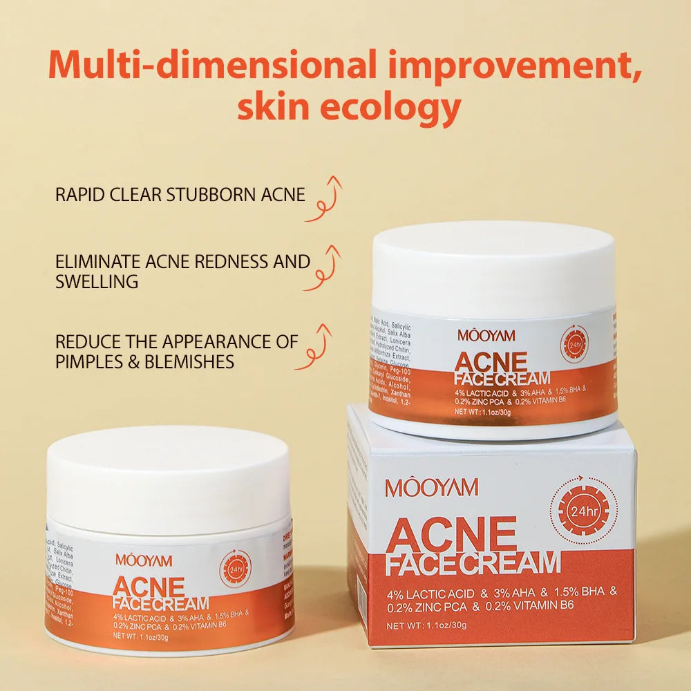 Herbal Acne Removal Face Cream Improve Acne Gel Lighten Acne Scar Pore Shrinking Eliminate Large Pores Pimples Brighten Face Car