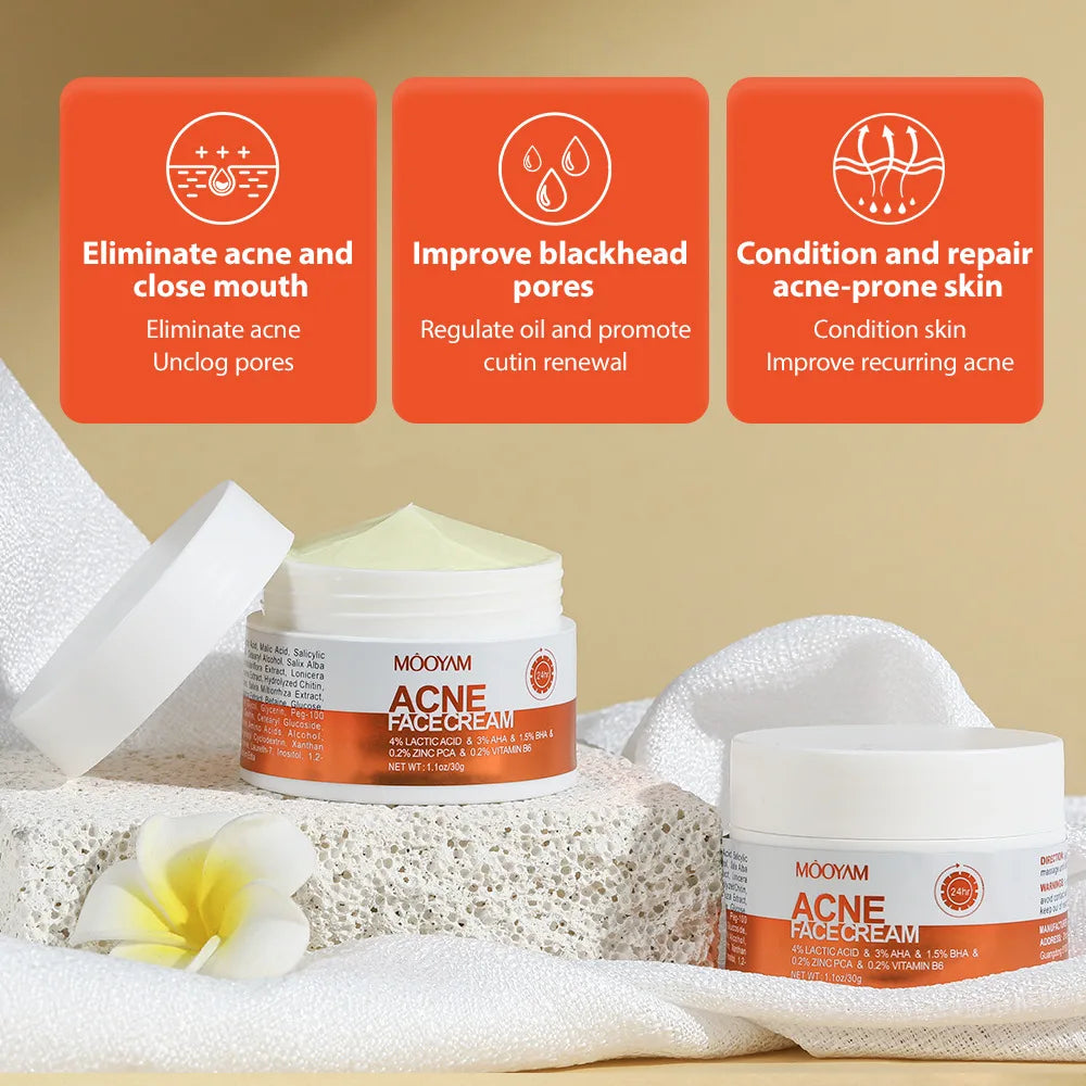 Herbal Acne Removal Face Cream Improve Acne Gel Lighten Acne Scar Pore Shrinking Eliminate Large Pores Pimples Brighten Face Car